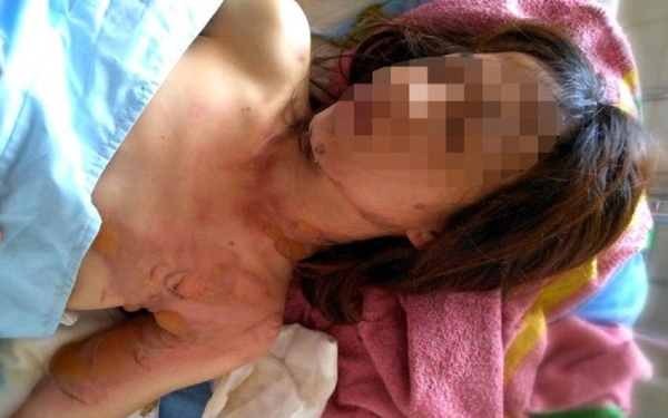 Sự thật không ngờ đằng sau vụ người phụ nữ bị phóng hỏa, cướp 500 triệu đồng