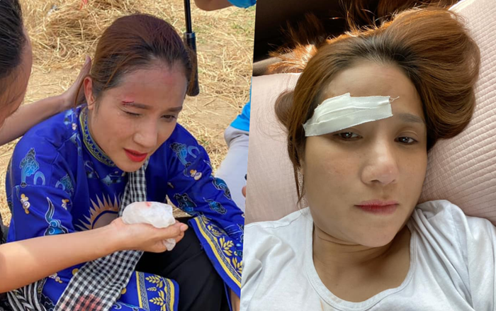 Diễn viên Cát Tường gặp tai nạn, phải khâu sống không thuốc tê tại phim trường