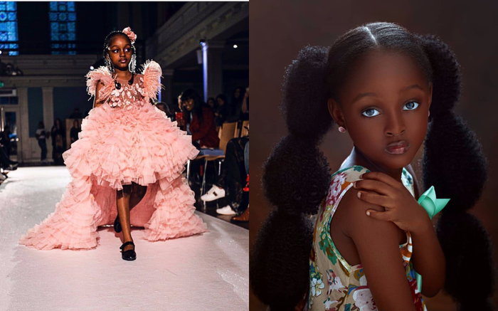 Sau 2 năm trở thành cô bé đẹp nhất thế giới, nhan sắc và sự nghiệp của 'ngọc trai đen' bây giờ ra sao?