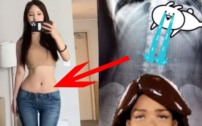 Thực hư tin đồn tác giả webtoon đình đám True Beauty’ bị tố phẫu thuật thẩm mỹ để có thân hình đồng hồ cát