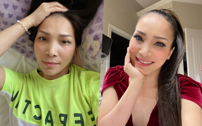 Nhan sắc của Hồng Ngọc sau 1 thời gian bị bỏng: Như một phép màu thần kì