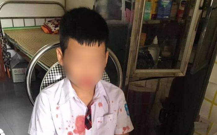 Phụ huynh vào trường đưa bé trai 7 tuổi ra ngoài hành hung để giải quyết mâu thuẫn cho con