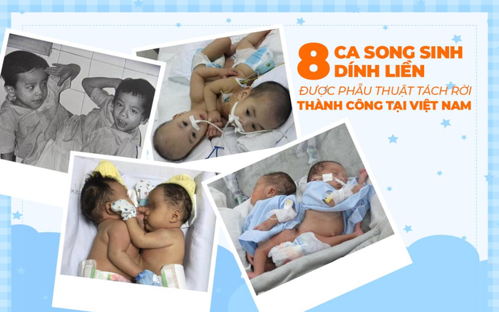 Nhìn lại 8 ca song sinh dính liền được phẫu thuật tách rời thành công ở Việt Nam