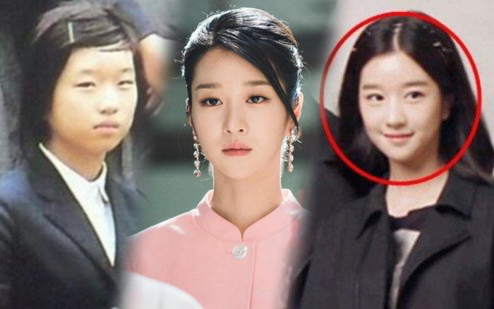 'Điên nữ' Seo Ye Ji đẹp tự nhiên từ bé, ảnh tố phẫu thuật thẩm mỹ là sao?
