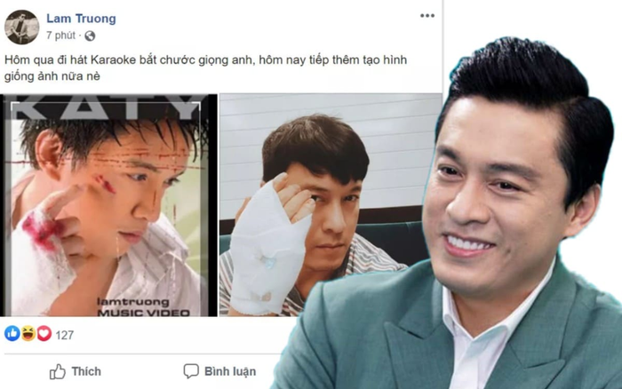 Băng bó kín tay vì trật khớp, Lam Trường tranh thủ tái hiện lại ảnh bìa CD đình đám gần chục năm trước khiến fan 'cạn lời'