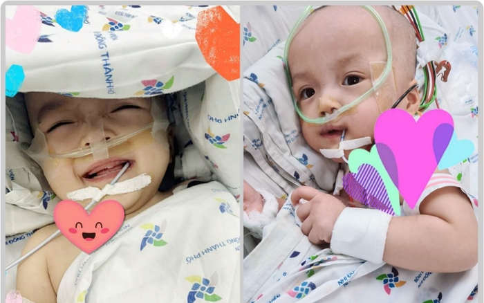 Tin vui: Hai bé Trúc Nhi - Diệu Nhi đã cai máy thở, sức khoẻ ổn định