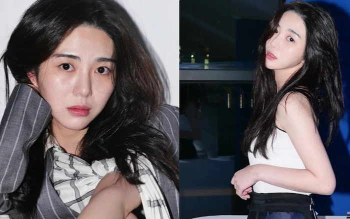 Cựu thành viên AOA Kwon Mina xuất viện, chưa có kế hoạch hoạt động trong thời gian sắp tới