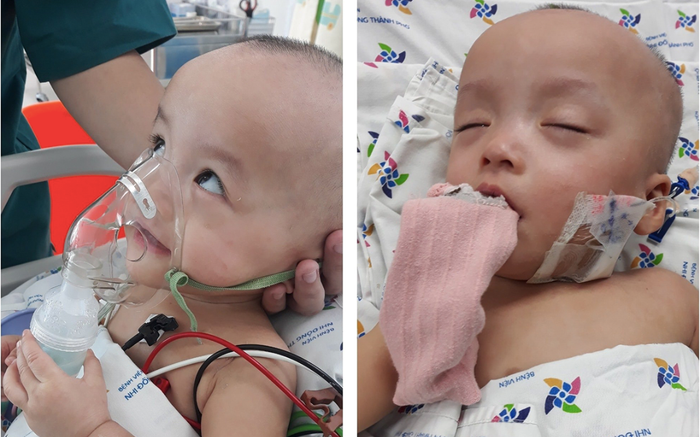 Hình ảnh mới hai bé Trúc Nhi - Diệu Nhi trong quá trình được chăm sóc đặc biệt tại bệnh viện Nhi đồng TP HCM
