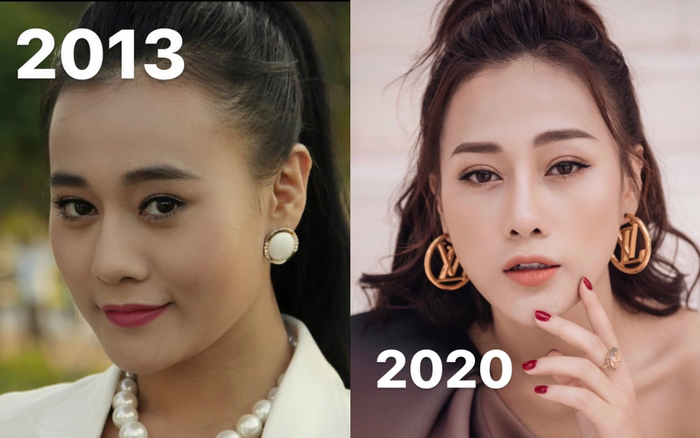 Phương Oanh tự so sánh hình ảnh nhan sắc thay đổi sau 7 năm nhờ phẫu thuật thẩm mỹ
