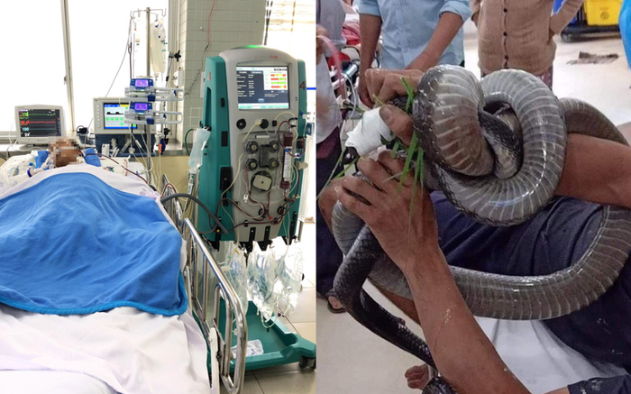 Người đàn ông bị rắn hổ mang chúa cắn đã được phẫu thuật vết thương, chuẩn bị ghép da