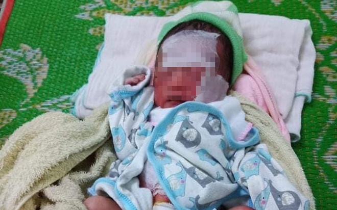 Bé gái sơ sinh bị bỏ rơi cả ngày dưới nắng nóng trong rẫy bắp ở Đắk Lắk