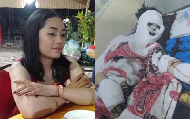 Gã 'ác quỷ' tạt axit, chặt tay bạn gái vì 'đòi chia tay'