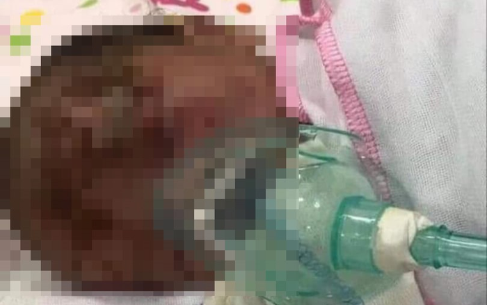 Phát hiện một bé trai khoảng 3 ngày tuổi bị bỏ rơi ven đường, trên mặt có nhiều vết xước