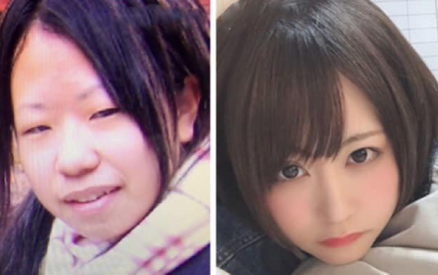 Màn lột xác ngoạn mục 'vịt hoá thiên nga' của cô gái từng trầm cảm vì xấu xí