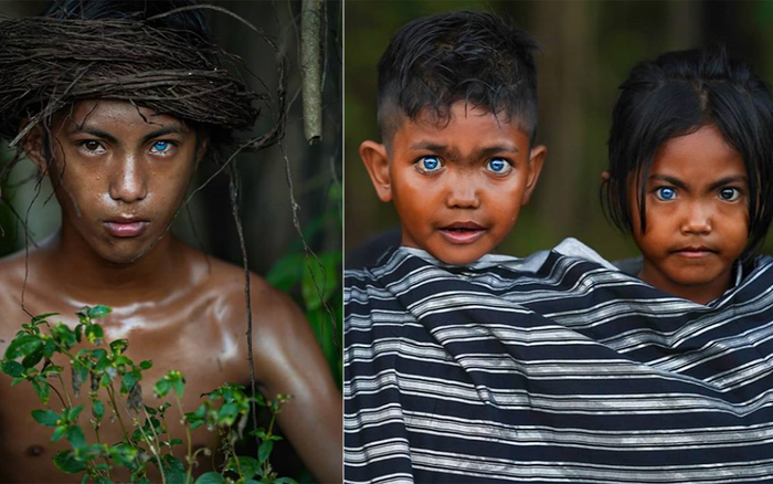 Bộ lạc mắc hội chứng hiếm gặp khiến màu mắt xanh như biển sâu