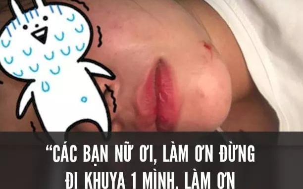 Về nhà lúc 1h sáng, nữ sinh gặp kẻ biến thái kề dao vào cổ và lời gửi gắm khẩn thiết: 'Các bạn nữ làm ơn đừng đi khuya một mình'