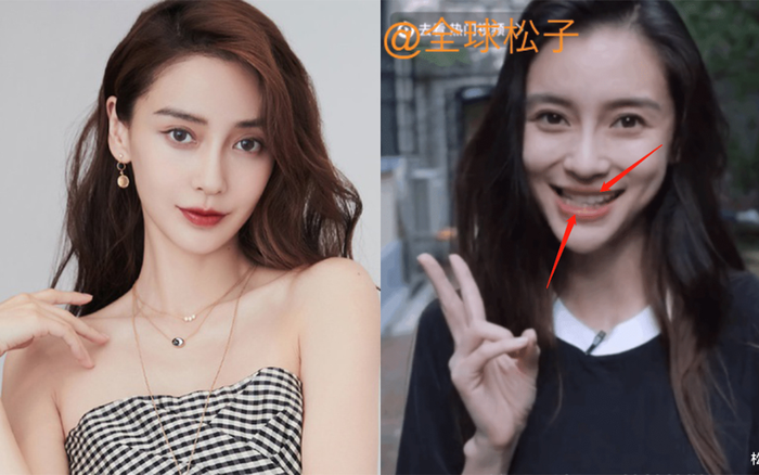 Angelababy bị nghi ngờ gặp biến chứng thẩm mỹ: Khuôn mặt cứng đơ, nhan sắc đáng báo động!