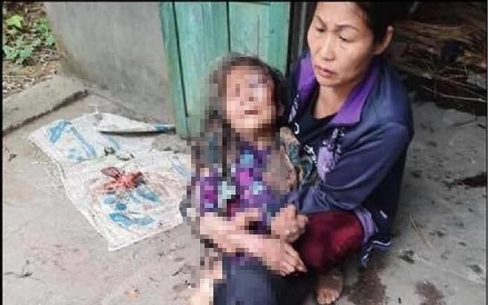 Bà cụ gần 90 tuổi bị nam thanh niên lẻn vào nhà đánh, châm lửa thiêu sống cướp hơn 21 triệu đồng: Nạn nhân đang hoảng loạn