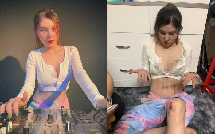 Nữ DJ bị cướp 'kéo lê' 3m trên đường bức xúc lên tiếng khi dân mạng 'soi mói' ngoại hình