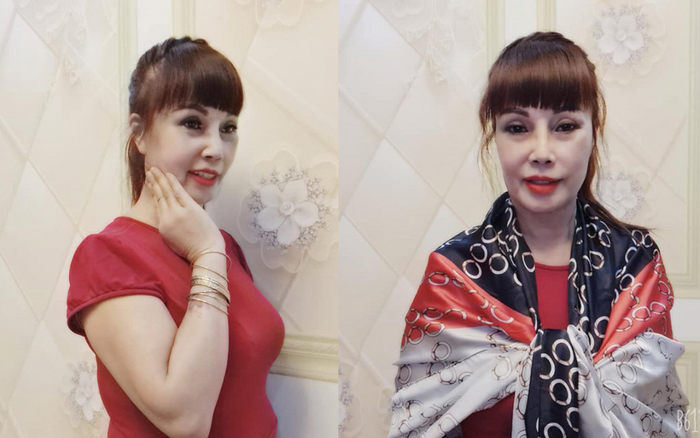 'Cô dâu 62 tuổi' gây bất ngờ với nhan sắc trẻ đẹp 'không tỳ vết' sau khi điều trị biến chứng phẫu thuật