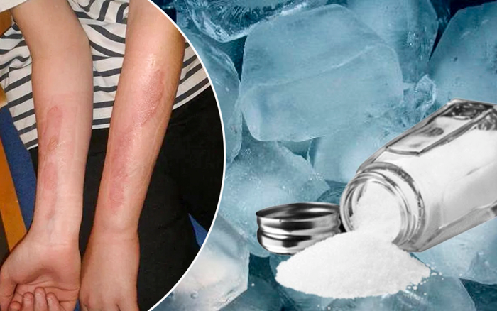 Cảnh báo về thử thách độc hại có thể khiến giới trẻ bị thương tật vĩnh viễn