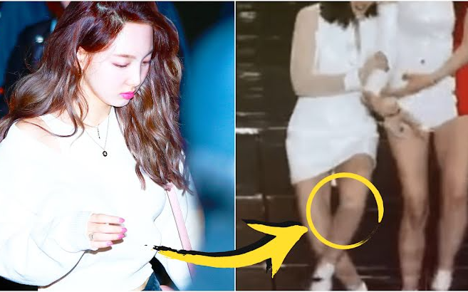 Bị di chứng ở chân, knet bất ngờ khi Nayeon (Twice) chưa bao giờ lười nhảy