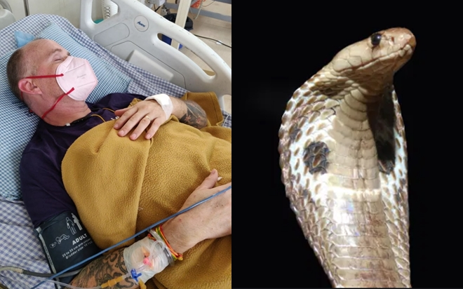 Bị rắn hổ mang cắn khi đang nằm điều trị COVID-19