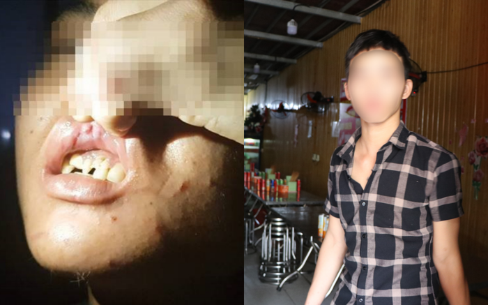 Anh trai nhân viên 15 tuổi nghi bị chủ quán bánh xèo đánh đập: 'Tôi rất xót, gia đình chưa biết chuyện'