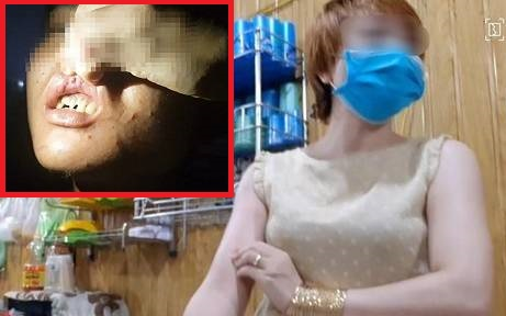 Chủ quán bánh xèo nghi bạo hành 2 nhân viên sống khép kín, từng đánh nhau với người bán hàng ngoài chợ