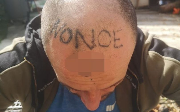 Tỉnh giấc sau cơn say, anh công nhân hốt hoảng phát hiện trên trán mình có hình xăm kì dị