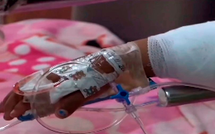 Người mẹ buộc rơm quanh tay con gái rồi châm lửa đốt để 'dạy cho một bài học'