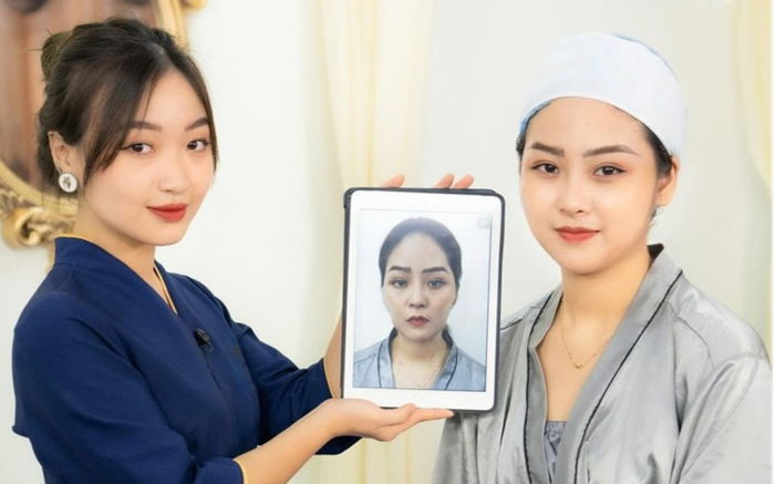 Khắc phục má hóp, gò má cao, thái dương lõm với tuyệt chiêu 'cải lão hoàn đồng'