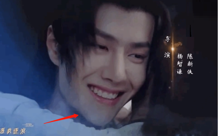 Vương Nhất Bác lộ dấu vết phẫu thuật thẩm mỹ trong Hữu phỉ: Mũi lộ sụn silicon, cằm nhọn hoắt?