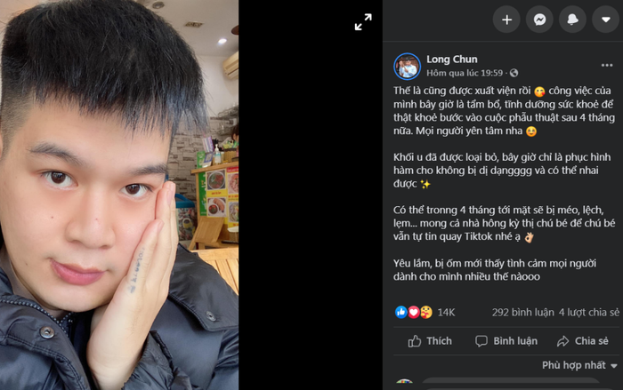 Xuất viện sau 1 tháng điều trị u men xương hàm, Long Chun mong khán giả không kì thị hình dáng