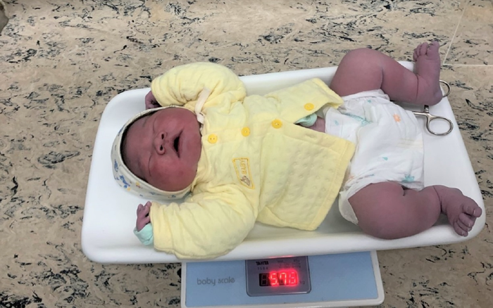 Bé trai nặng gần 6 kg chào đời thành công tại Bệnh viện Bệnh nhiệt đới Trung ương