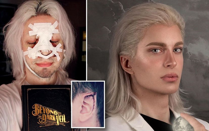 Chàng trai chi hơn 2,3 tỷ, trải qua 32 ca phẫu thuật để trở thành 'yêu tinh đời thực'