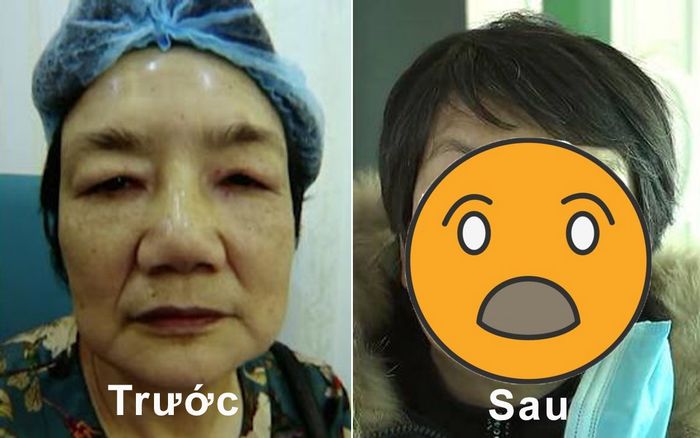 Chi 900 triệu đồng đi phẫu thuật thẩm mỹ, người phụ nữ bị chồng đuổi khỏi nhà vì tướng mạo dữ tợn