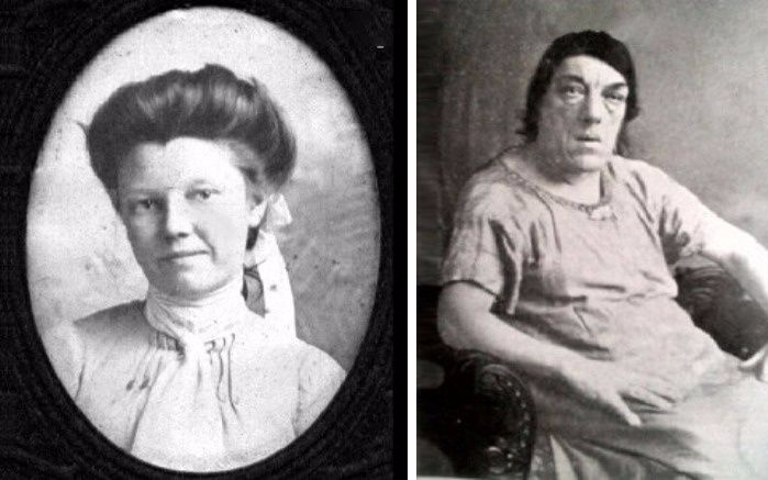 Chuyện cảm động về người phụ nữ xấu nhất thế giới phải 'bán mặt' để nuôi con