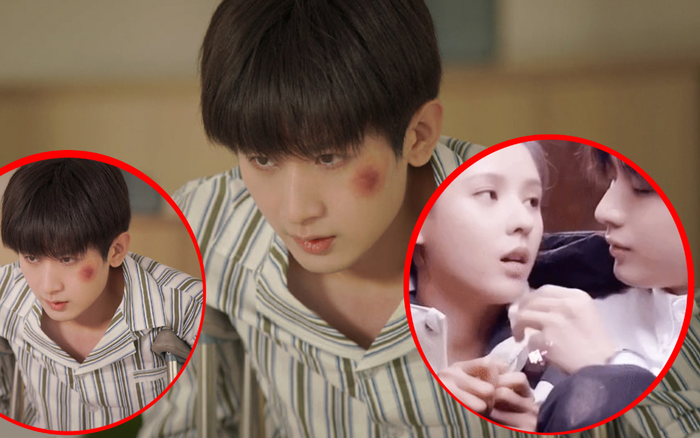 Trương Dư Hi đã làm gì khi Thành Nghị bị đánh bầm dập, lếch xe lăn trong phim Gió Nam Hiểu Lòng Tôi ?