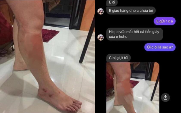 'Boom hàng chuyên nghiệp': Tải hẳn hình bị tai nạn xe để gửi cho shop