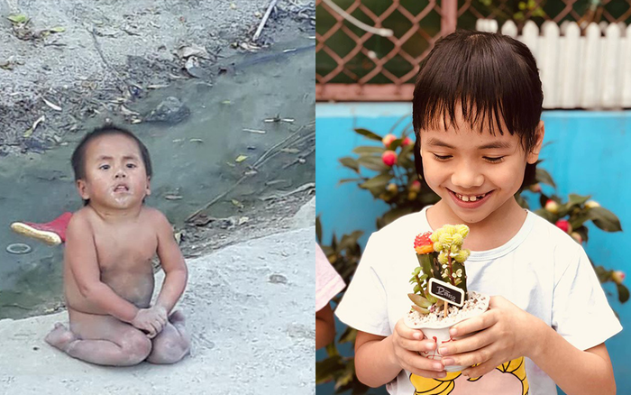 'Ngày ấy bây giờ' bé Pàng sau 4 năm được nhận nuôi: Hành trình kì diệu của tình yêu thương