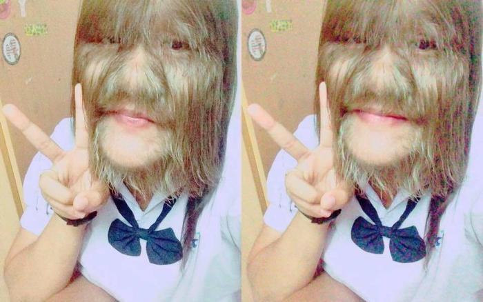 Diện mạo mới gây kinh ngạc của cô gái từng bị gọi là 'người sói', bị kỳ thị 10 năm vì căn bệnh hiếm gặp