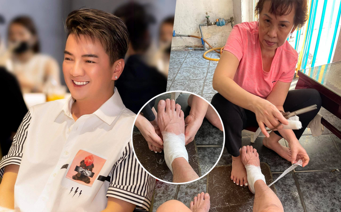 Đàm Vĩnh Hưng gặp tai nạn bị thương ở chân phải băng bó, tiết lộ nhận được 'điềm báo' từ trước