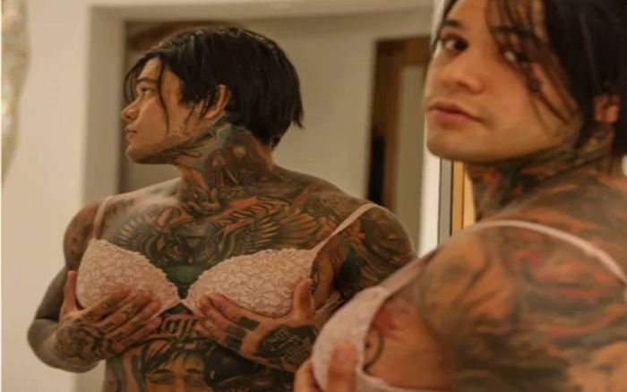 Người đàn ông chịu đau đớn đi cấy ghép ngực sau khi cá cược với anh rể