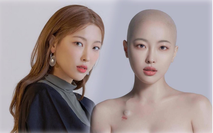 Người đẹp nổi tiếng Hàn Quốc bị ung thư: Sắp chết nhưng vẫn lạc quan!