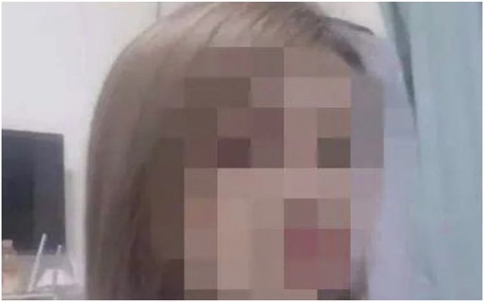 Người phụ nữ mặt trắng bệnh, co giật rồi chết não khi cấy ghép mỡ để làm đẹp