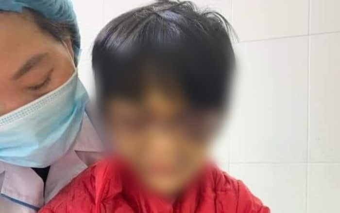 Khởi tố người mẹ nhốt con gái 6 tuổi vào phòng, đánh đập dã man vì con thường xuyên đi vệ sinh không bảo