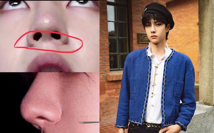 Không sợ bị kiện, blogger dám khẳng định Vương Nhất Bác phẫu thuật thu nhỏ cánh mũi