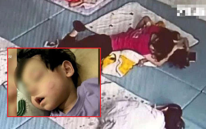 Bé trai đi học về mặt đầy vết bầm, bà mẹ xem lại camera thì phát hiện hành động bất thường của cô giáo