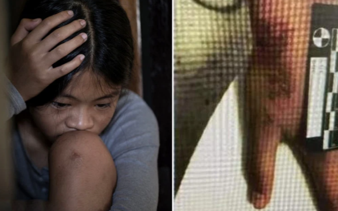 Học hành 'không đạt chuẩn của mẹ', bé gái 12 tuổi bị bạo hành dã man